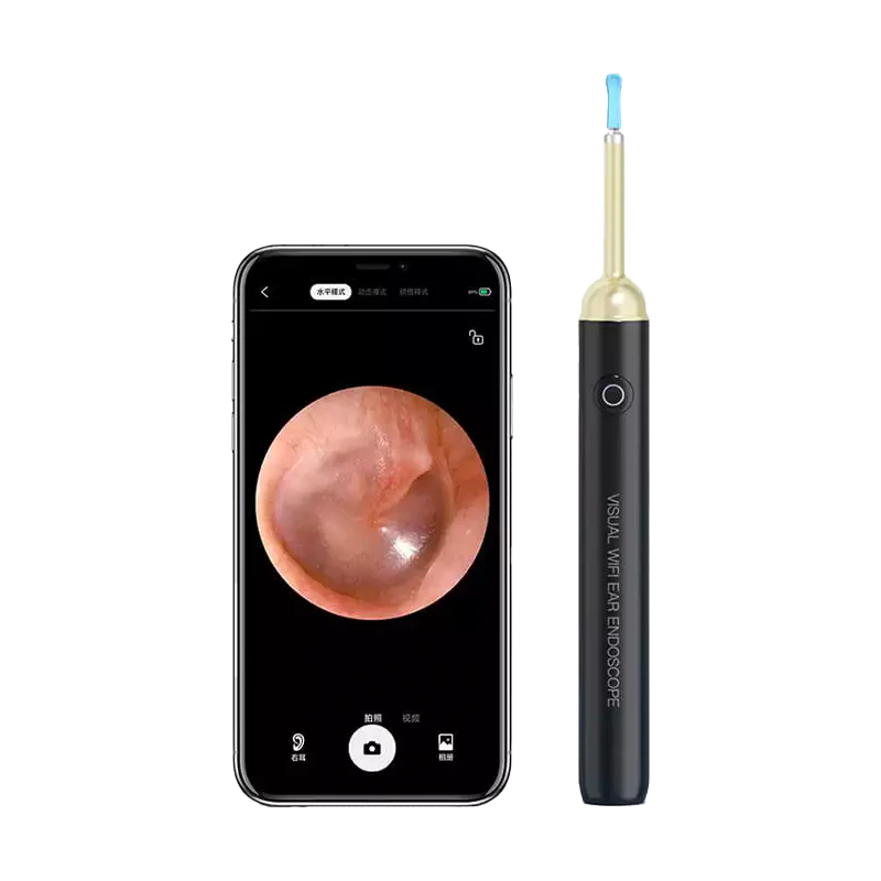 SUNUO Find S Smart Visual Ear Cleaner - Image 2